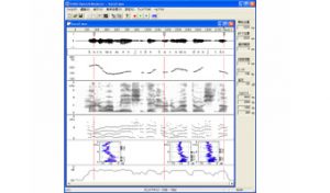 音声分析ソフト「杉スピーチアナライザー」